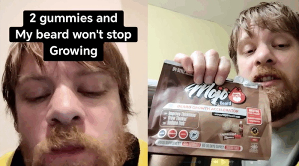 Beard Growth Gummies TikTok